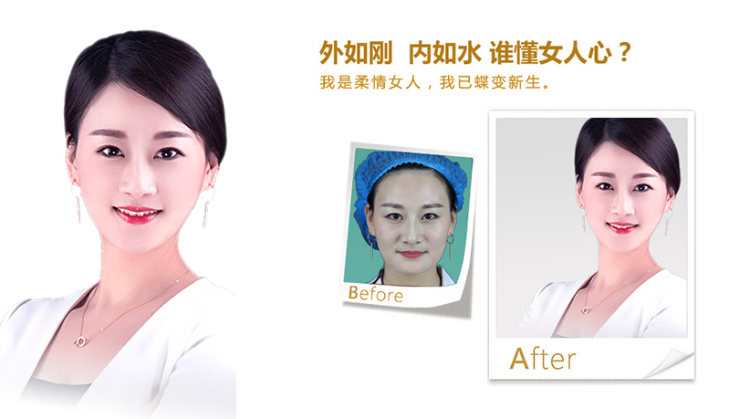 新余V脸、线雕隆鼻